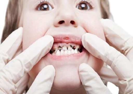 كيف تُحافظ على صحة أسنان طفلك؟