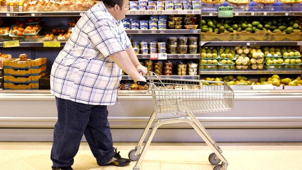 تقرير طبي يوصي بعمليات تصغير معدة 800 ألف بريطاني